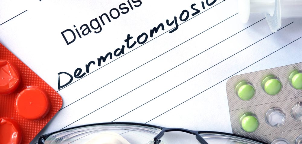 Extension Study Gets Underway for Resunab as Treatment for Dermatomyositis Patients